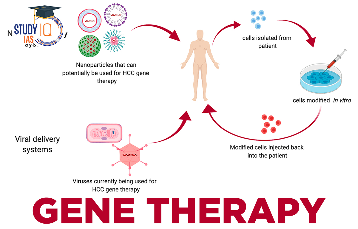 Gene Therapy