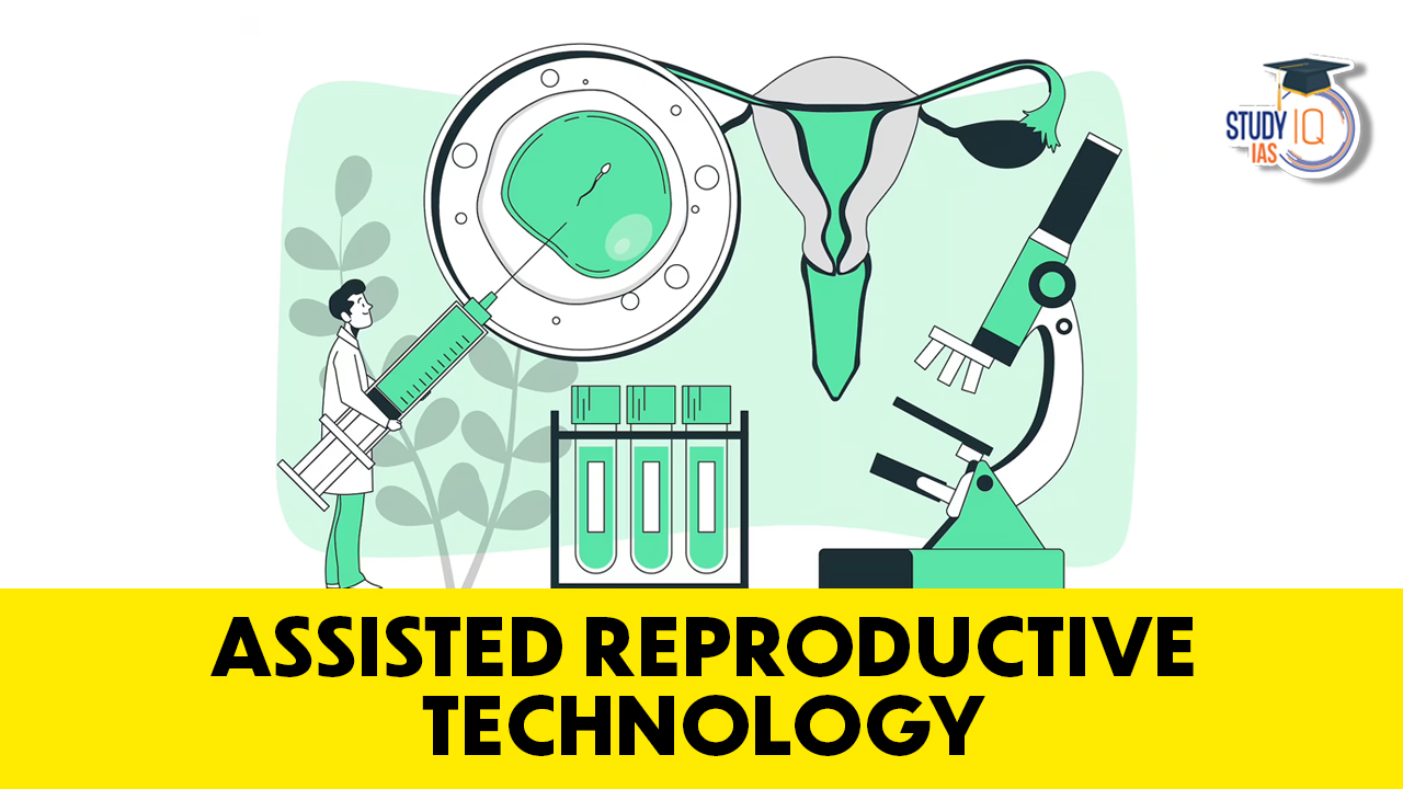 Assisted Reproductive Technology