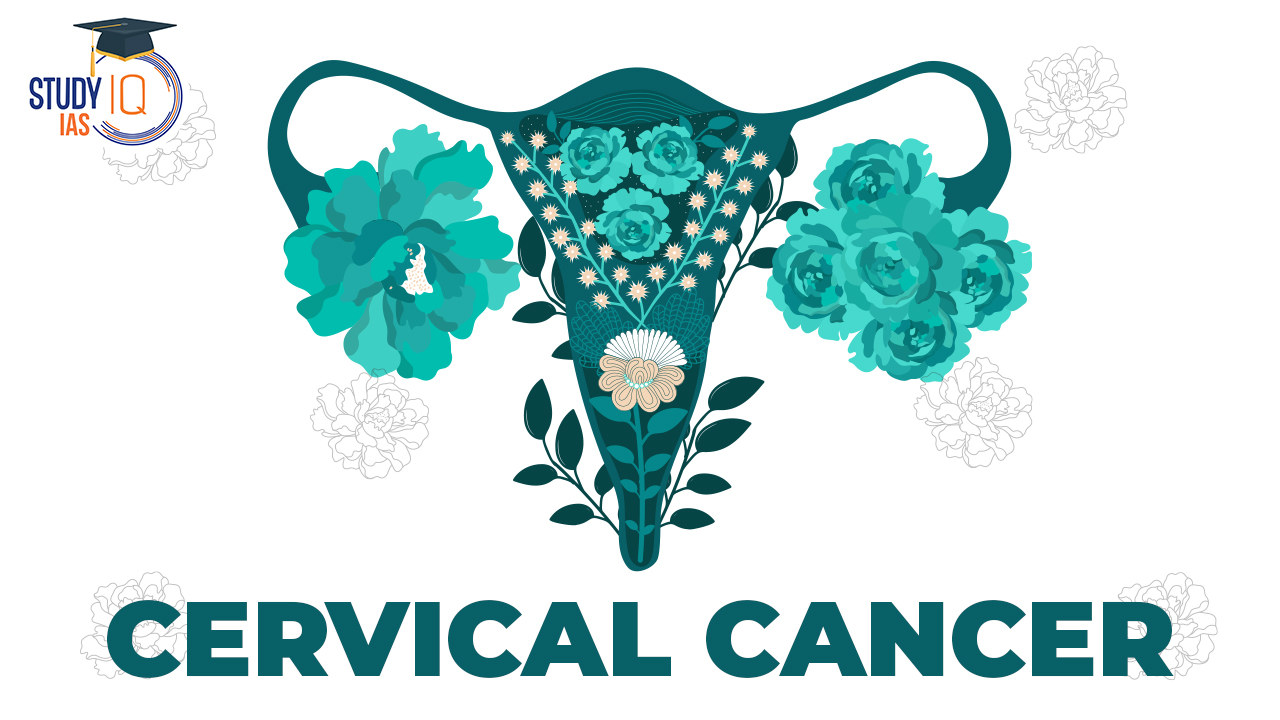 Cervical cancer