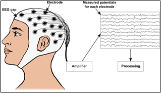 What is Electroencephalography (EEG)?_4.1