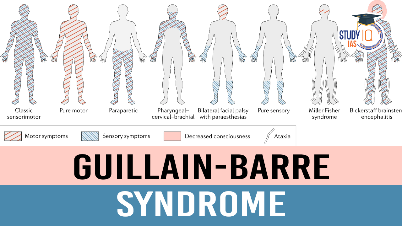 Guillain-Barre Syndrome (blog)