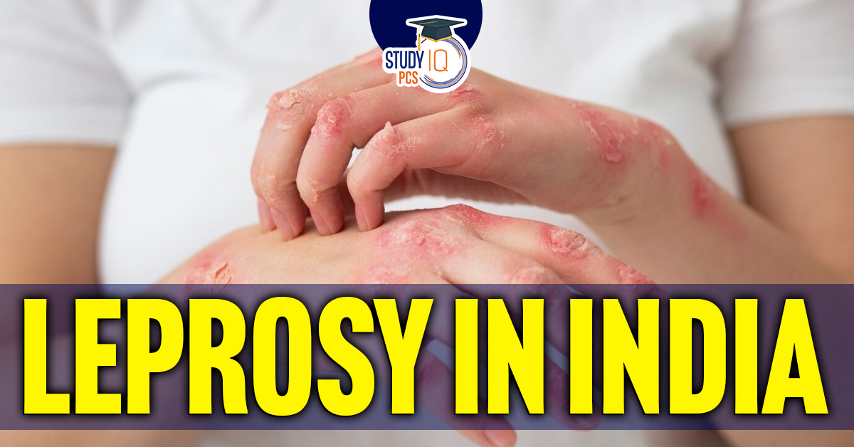 Leprosy in India