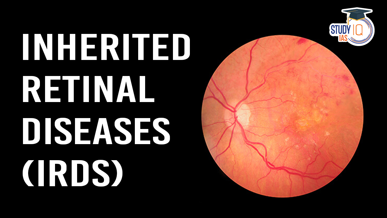 Inherited Retinal Diseases (IRDs)